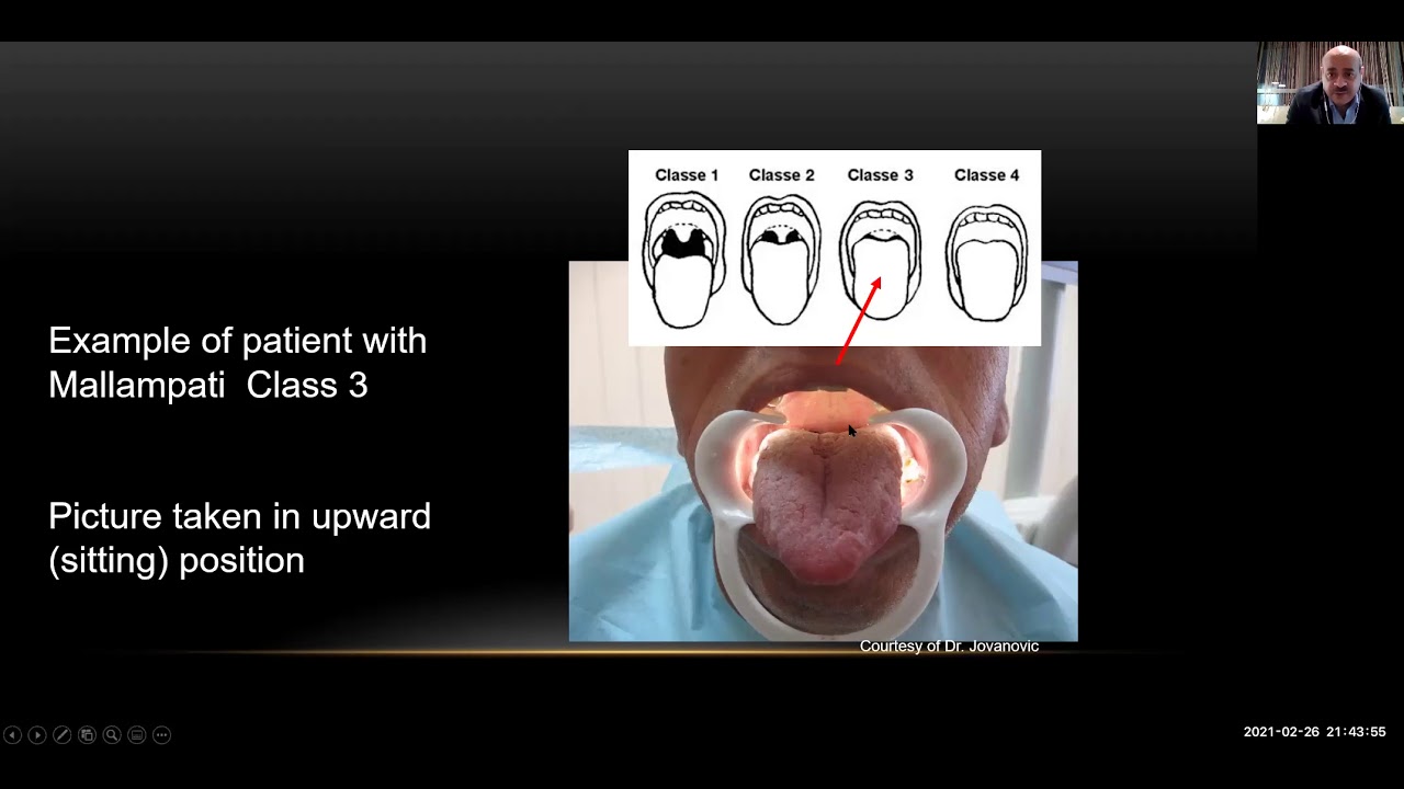 Prof. Ashraf Badawi talk Laser treatment of snoring using the Fotona SP Dynamis