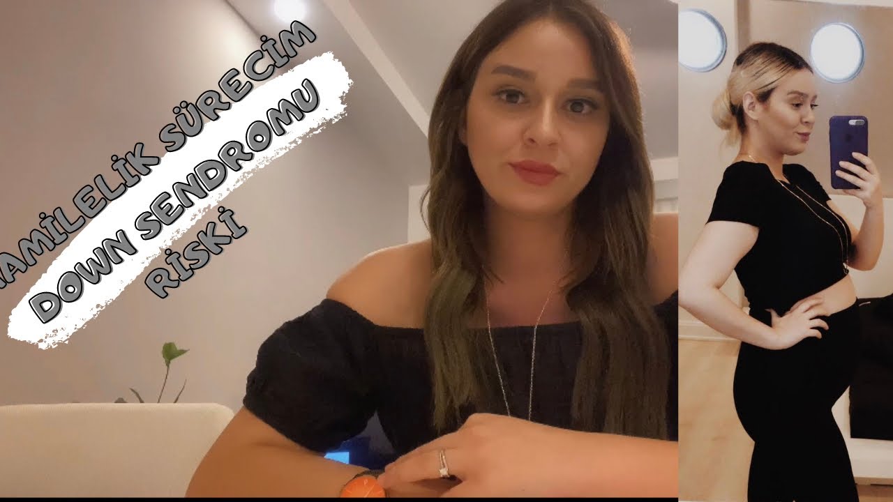 HAMİLELİK S&Uuml;RECİM,İKİLİ TARAMA (DOWN SENDROMU) RİSKİ VE AMNİYOSENTEZ NELER YAŞADIM?