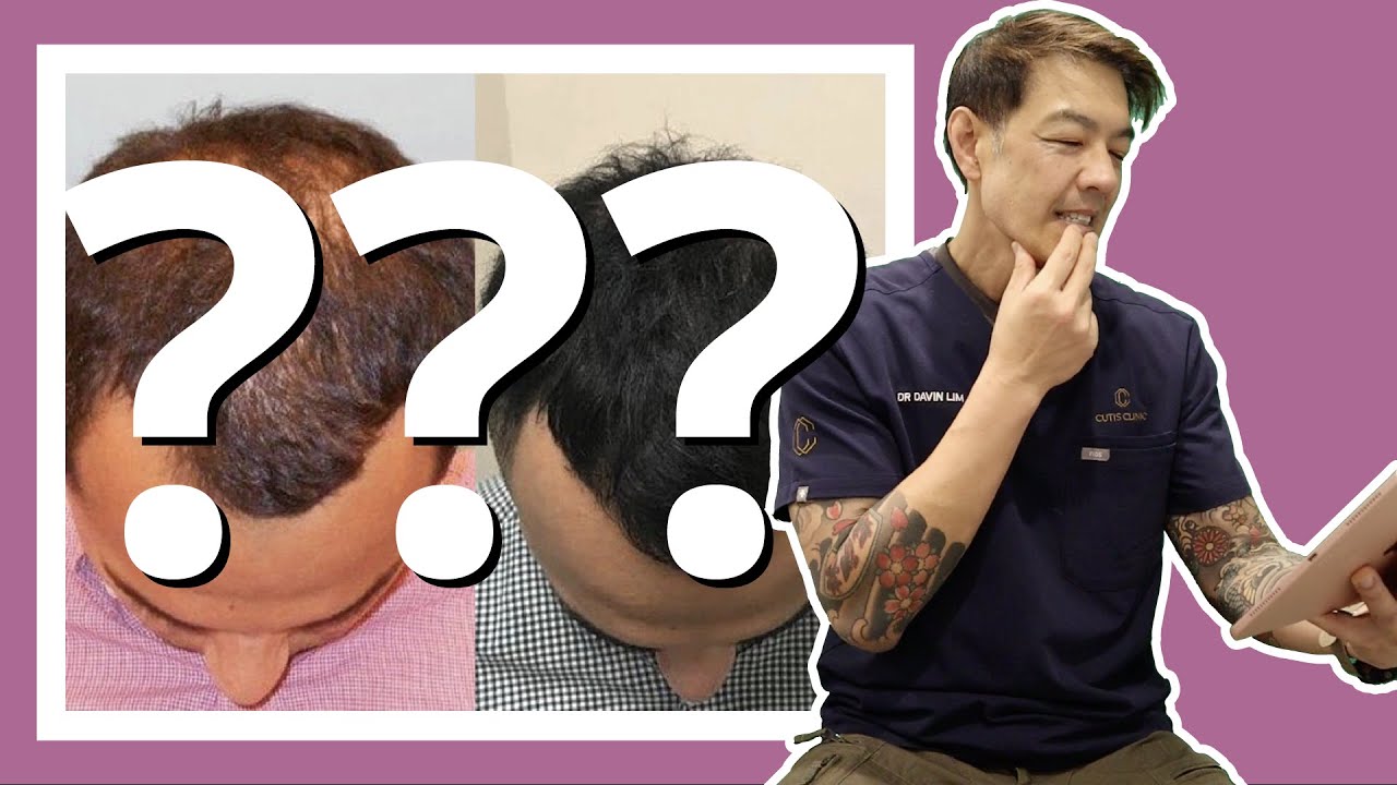 Guessing the treatment from JUST Before and After photos | Dr Davin Lim