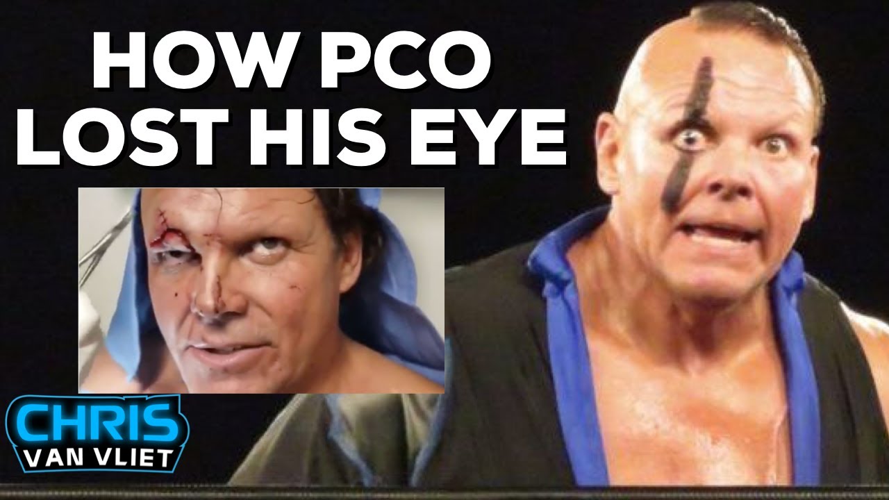 The crazy story of how PCO lost his eye - Chris Van Vliet Clips