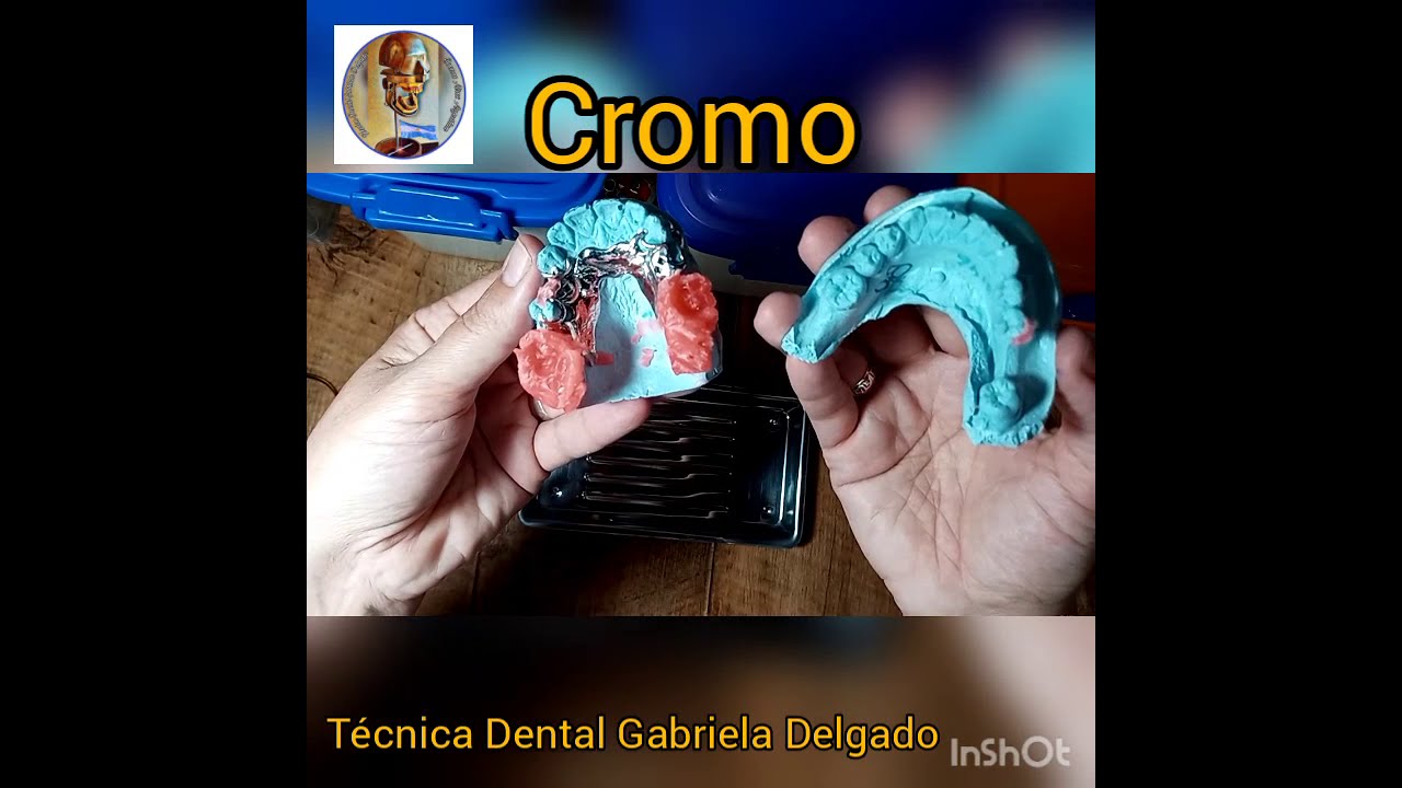 Cromo,de principio hasta la prueba de oclusión (primera parte).😊📌📚