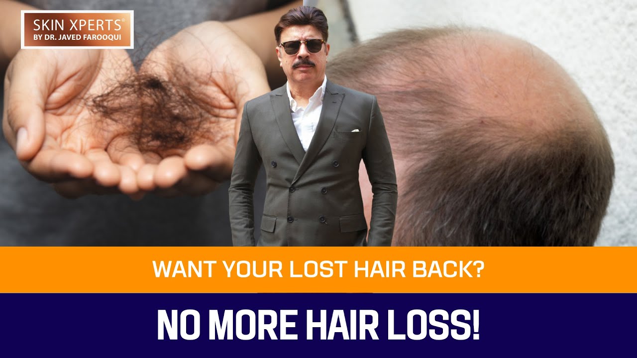 Hair Fall Treatment | Hair Loss Causes and Solution | Dr Javed Alam Farooqui | #hairloss #fue