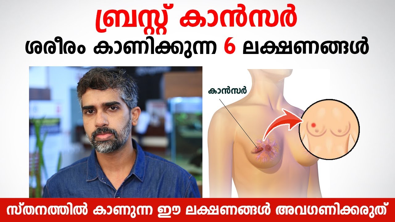 ബ്രസ്റ്റ് കാൻസർ ശരീരം കാണിക്കുന്ന 6 ലക്ഷണങ്ങൾ | Breast cancer symptoms | Dr. Prashanth Parameswaran