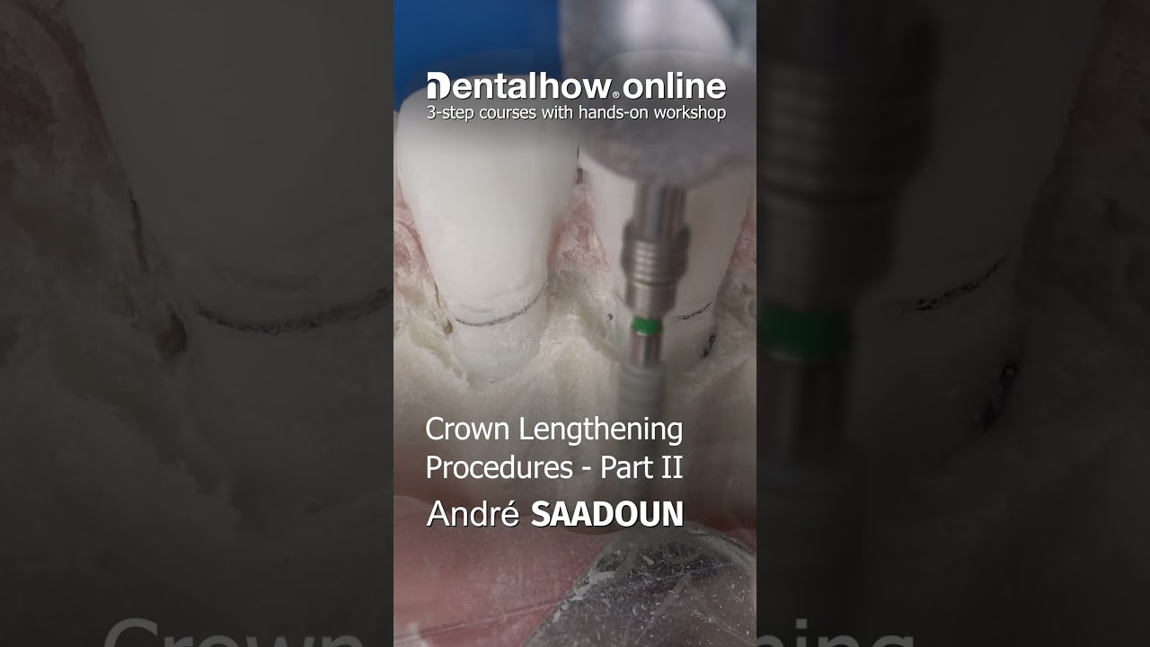 Dr. Andr&eacute; Saadoun | Online Course 2023  #dentist #dentistry #education #smile #dental #shorts