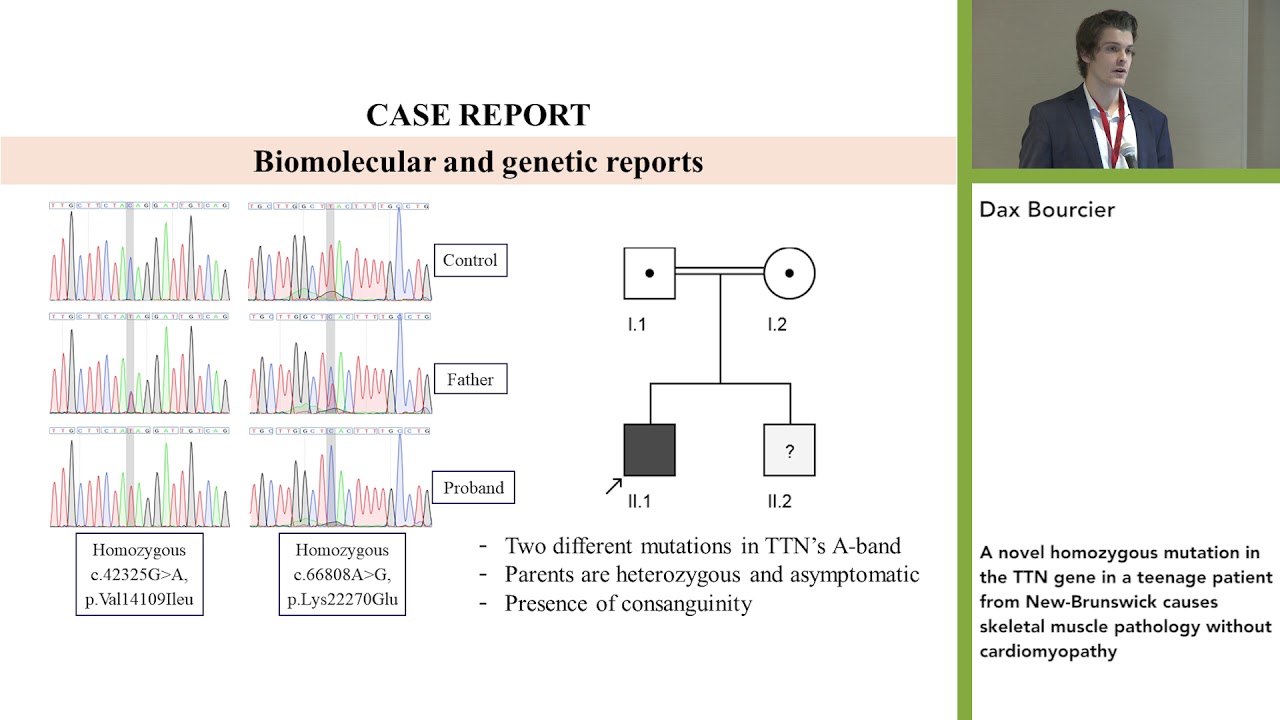 Homozygous mutation in the TTN gene in a teenage causes skeletal muscle pathology w/o cardiomyopathy