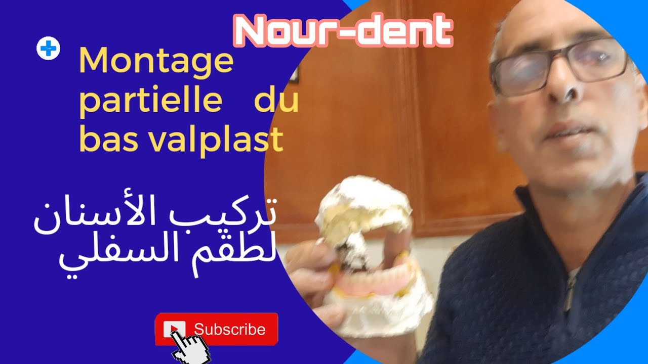 Montage partielle du bas valplast.  تركيب الأسنان لطقم السفلي. @NoureddineVlogsBr