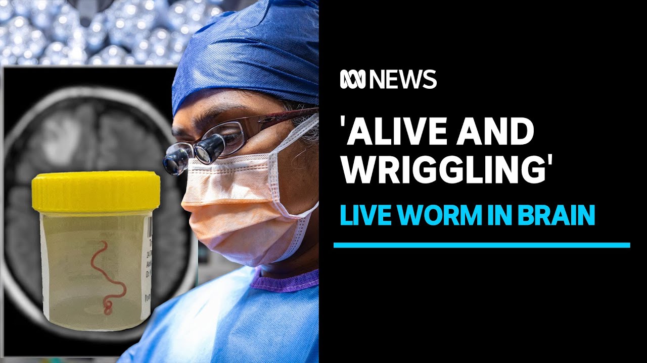 Living roundworm pulled from brain of patient | ABC News