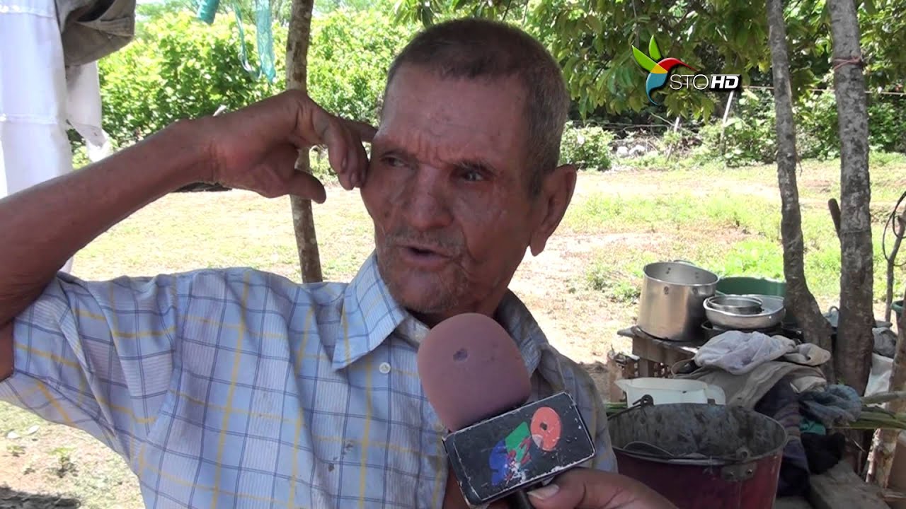 Pobreza extrema en campos bananeros de Olanchito.