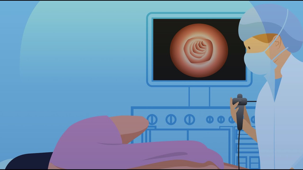 What Happens During a Colonoscopy: What The Health