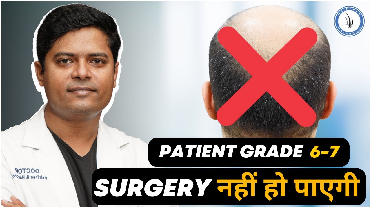 Doctor nai kaha Surgery नहीं हो पाएगी  | Grade 6-7 | Hair Transplant in Mumbai
