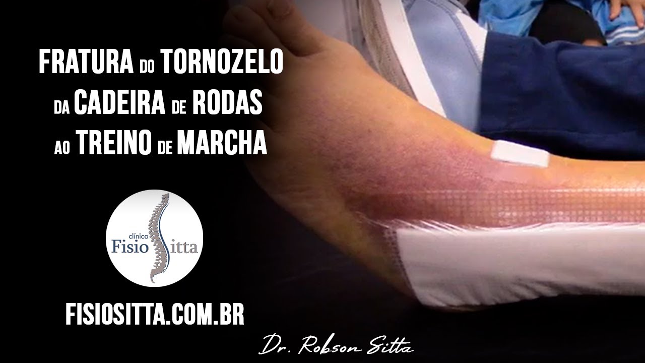 FRATURA do TORNOZELO TREINO DE MARCHA DESDE O USO DA CADEIRA de RODAS Fisioterapia Dr. Robson Sitta