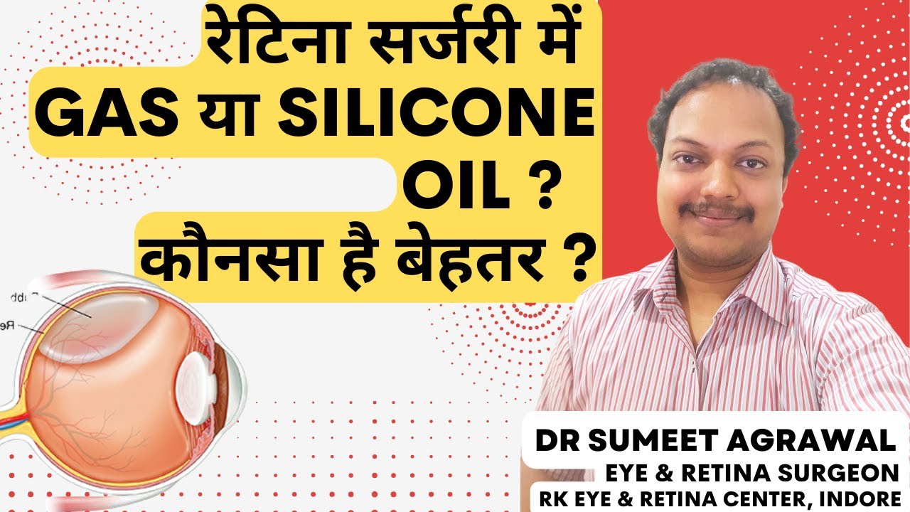 रेटिना सर्जरी में Gas या Silicone oil क्यों डाला जाता है ? Which is better for eyes, Gas or Oil ?