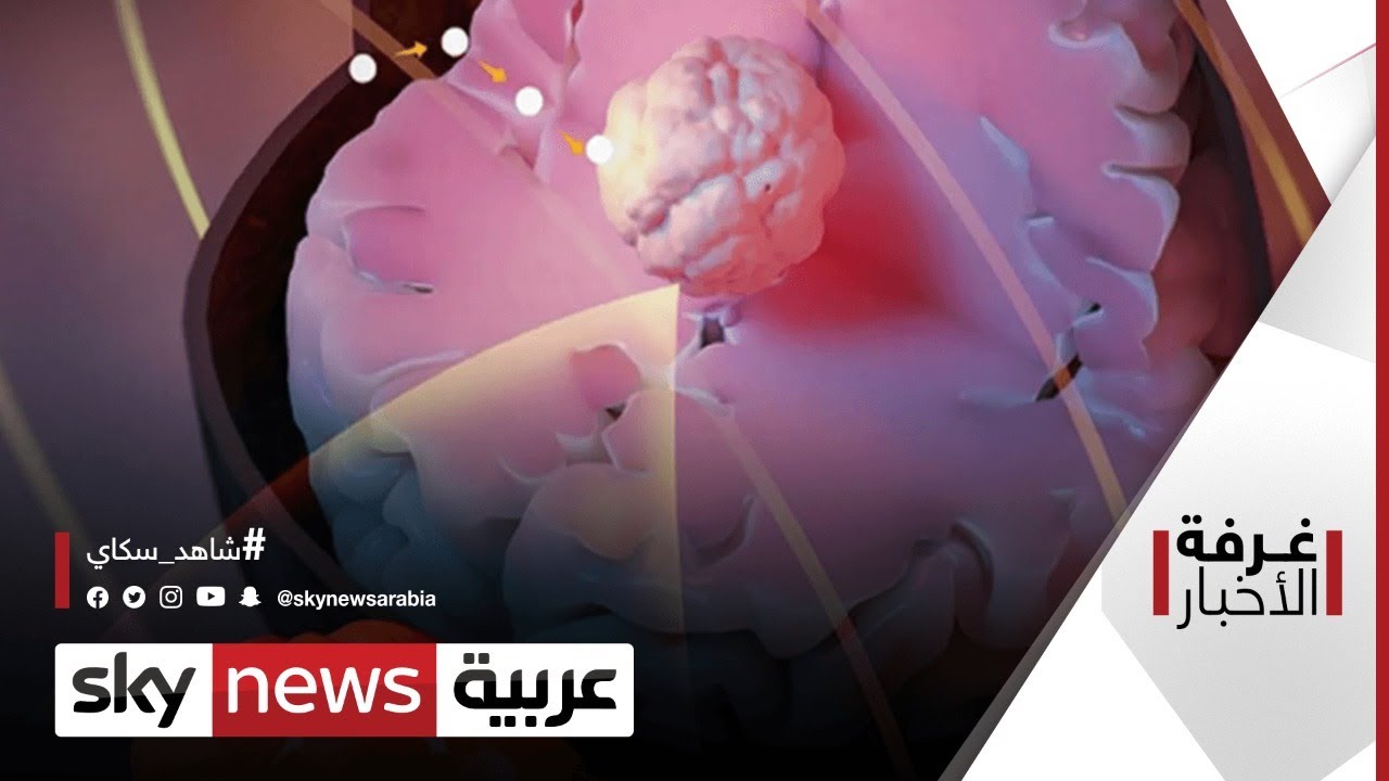 عالم الطب.. علاج ثوري للسرطان | 