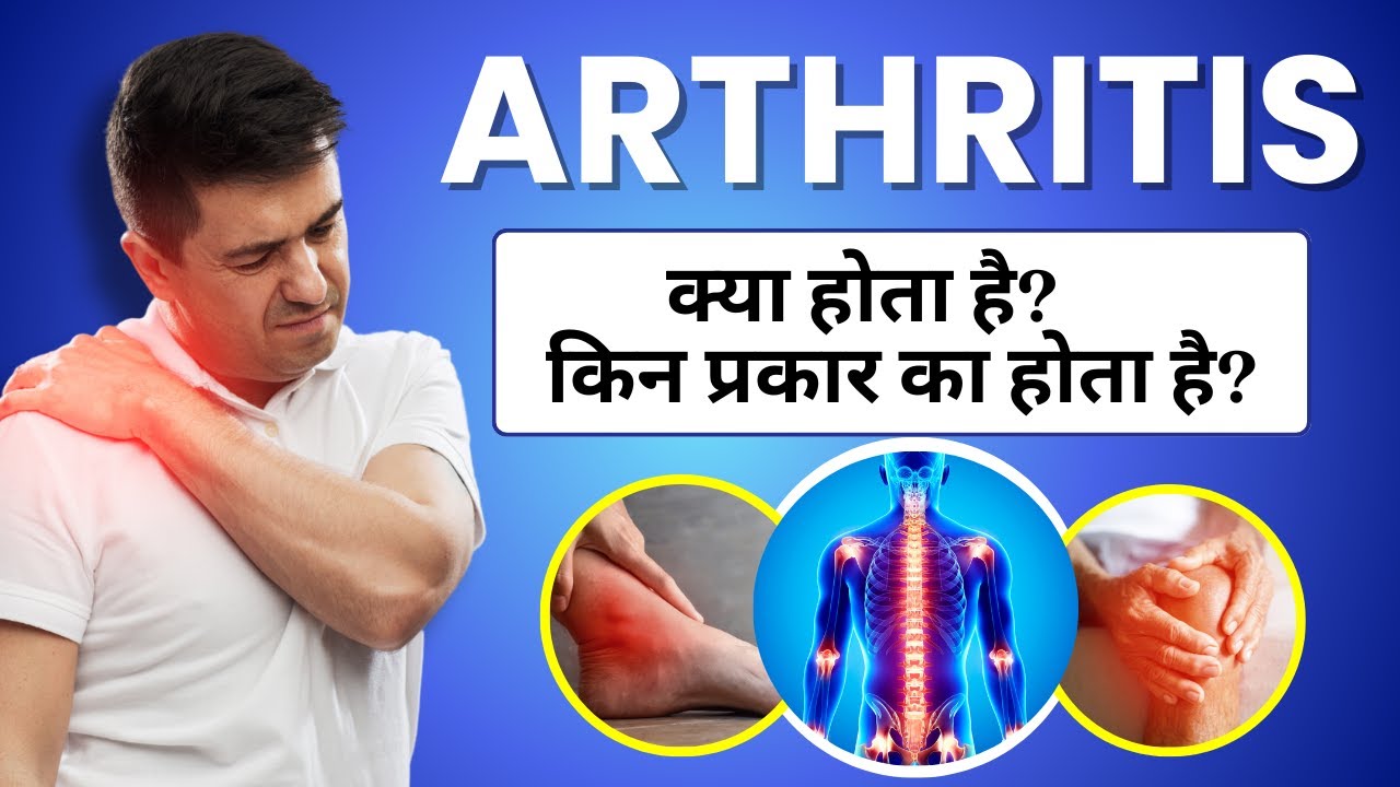 Arthritis Kya Hota Hai? Kitne Prakar ka Hota Hai? Different Types of Arthritis Explained in Hindi