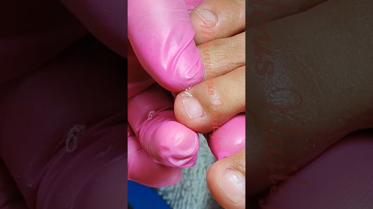 Full video pedicure and dryskin removal