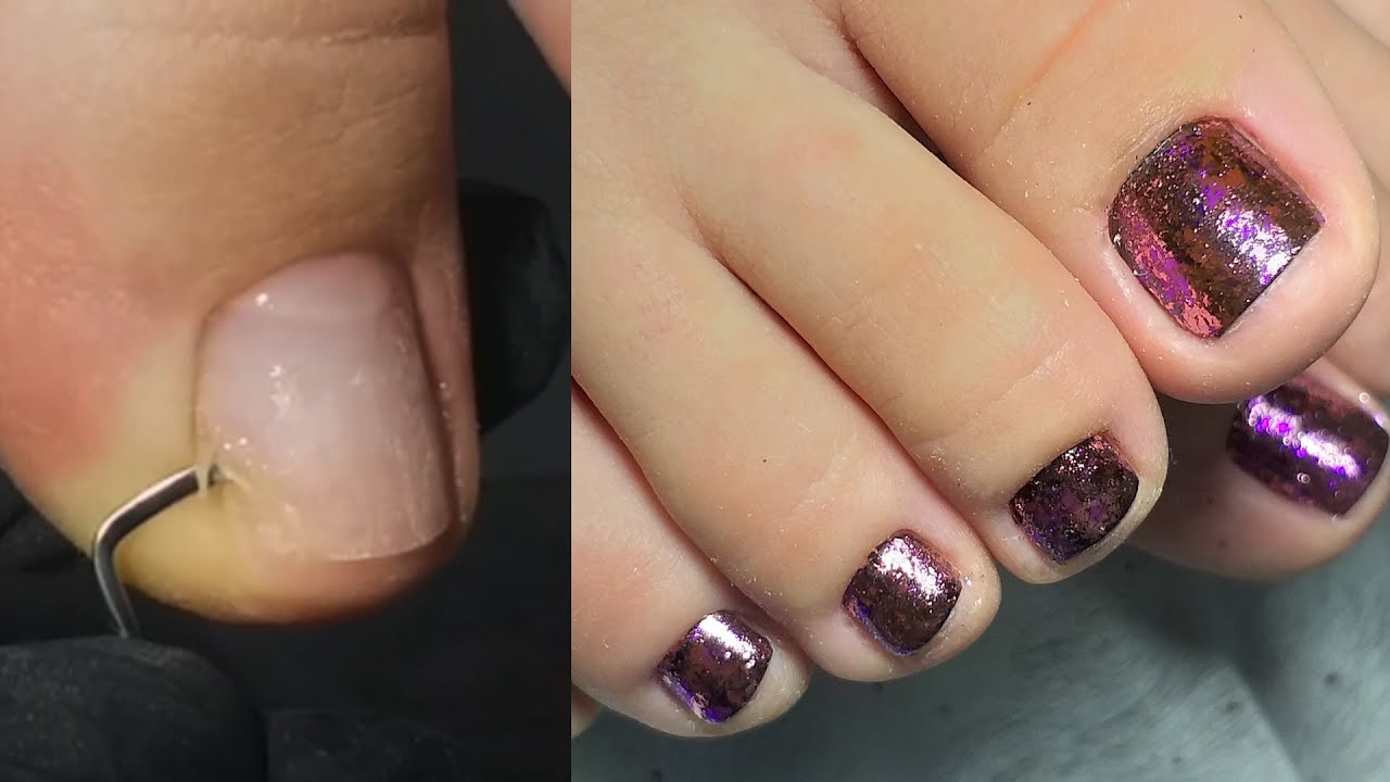 ❤ ЭКСПРЕСС педикюр ❤ ЗЛОВЕЩИЙ уголок ❤ ХЛОПЬЯ ЮККИ ❤КОРРЕКЦИЯ педикюр ❤