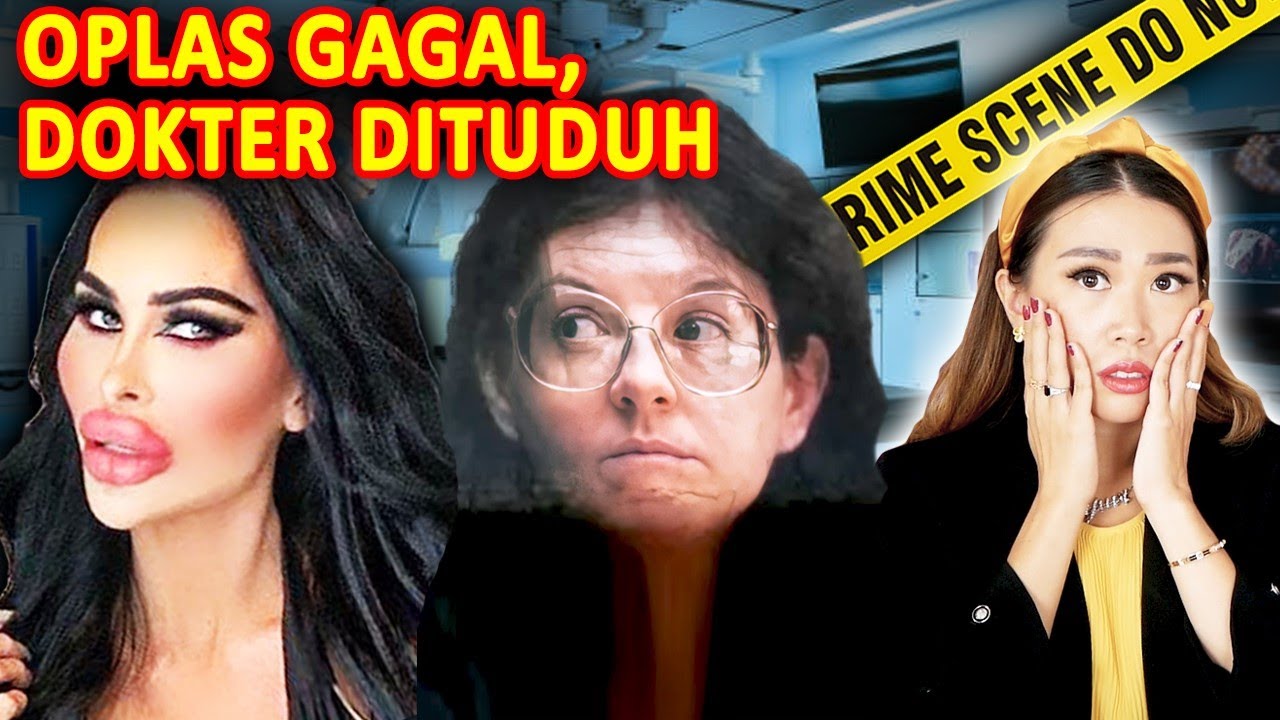OPLAS GAGAL, PASIEN BALAS DENDAM: KISAH THERESA RAMIREZ