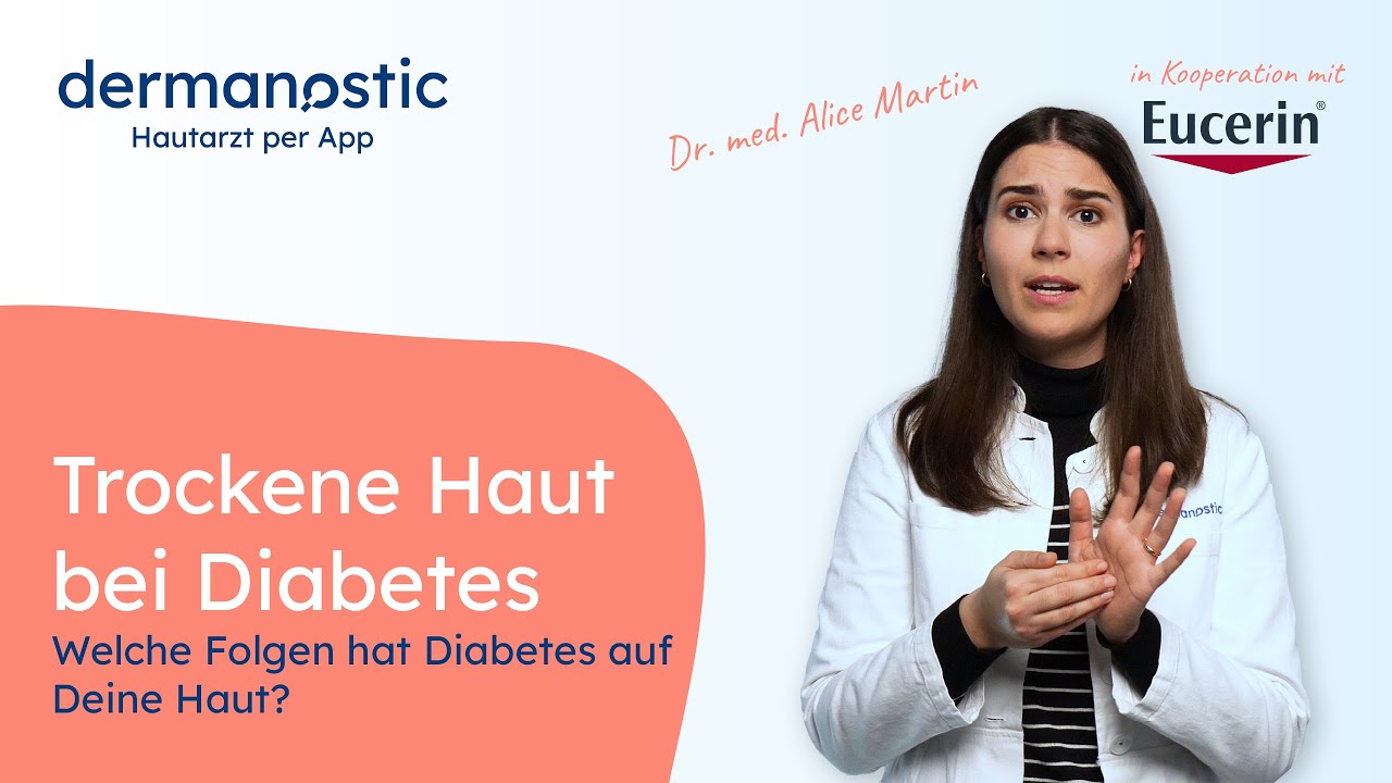 Trockene Haut bei Diabetes - Welche Folgen hat Diabetes auf Deine Haut?