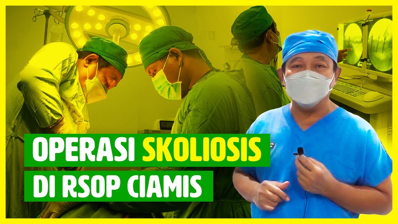 Operasi Skoliosis oleh ahlinya di RSOP Ciamis | SCOLIOSIS SURGERY