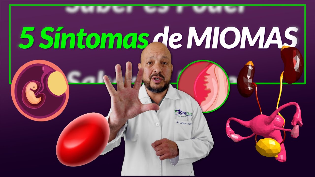 5 Síntomas de Miomas y qué significan [Sangrados, Abultamiento, Estreñimiento, Infertilidad, Anemia]