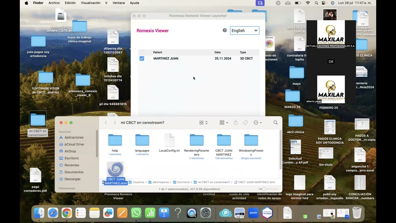 Instalación y apertura de CBCT en windows y mac 2025