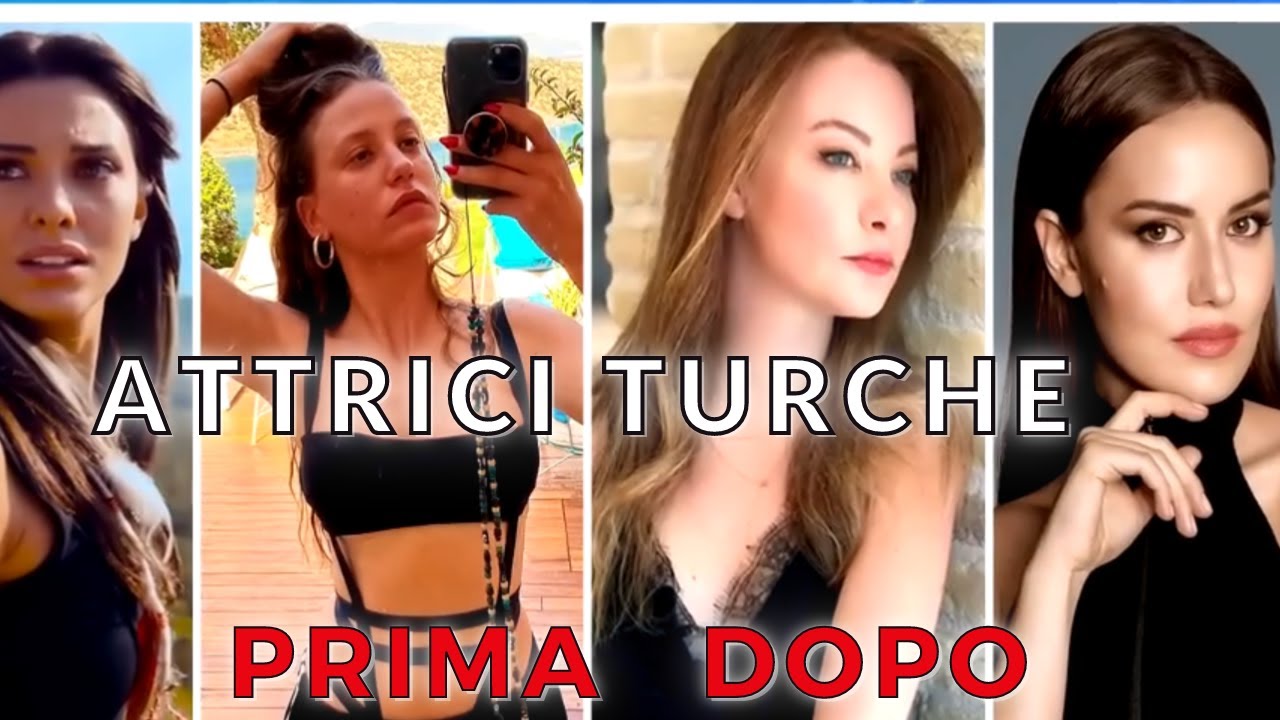 top 10 Attori Turchi Prima  e dopo la chirurgia estetica- verità rivelate o bugie nascoste