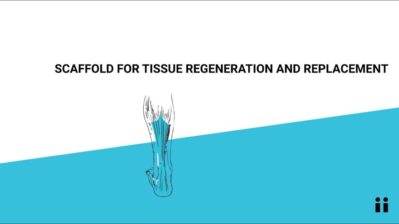 UniBo Patents: Scaffold for tissue regeneration and replacement