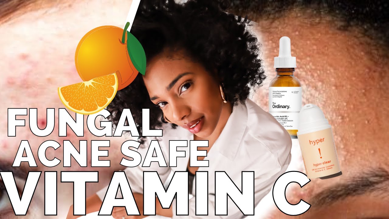 The BEST Vitamin C Serums | Fungal Acne (Malassezia) Safe