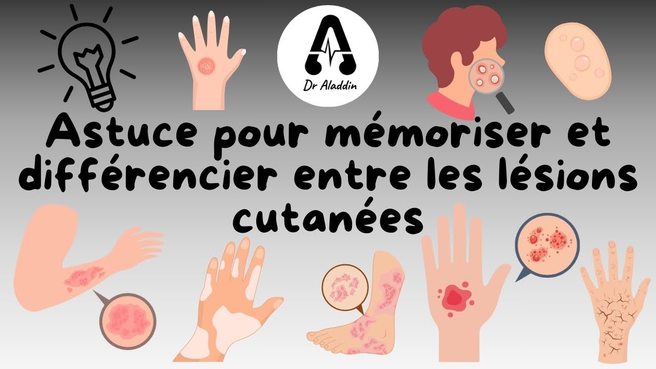Astuce pour mémoriser et différencier entre les lésions cutanées ( sémiologie cutanée ) #dermato