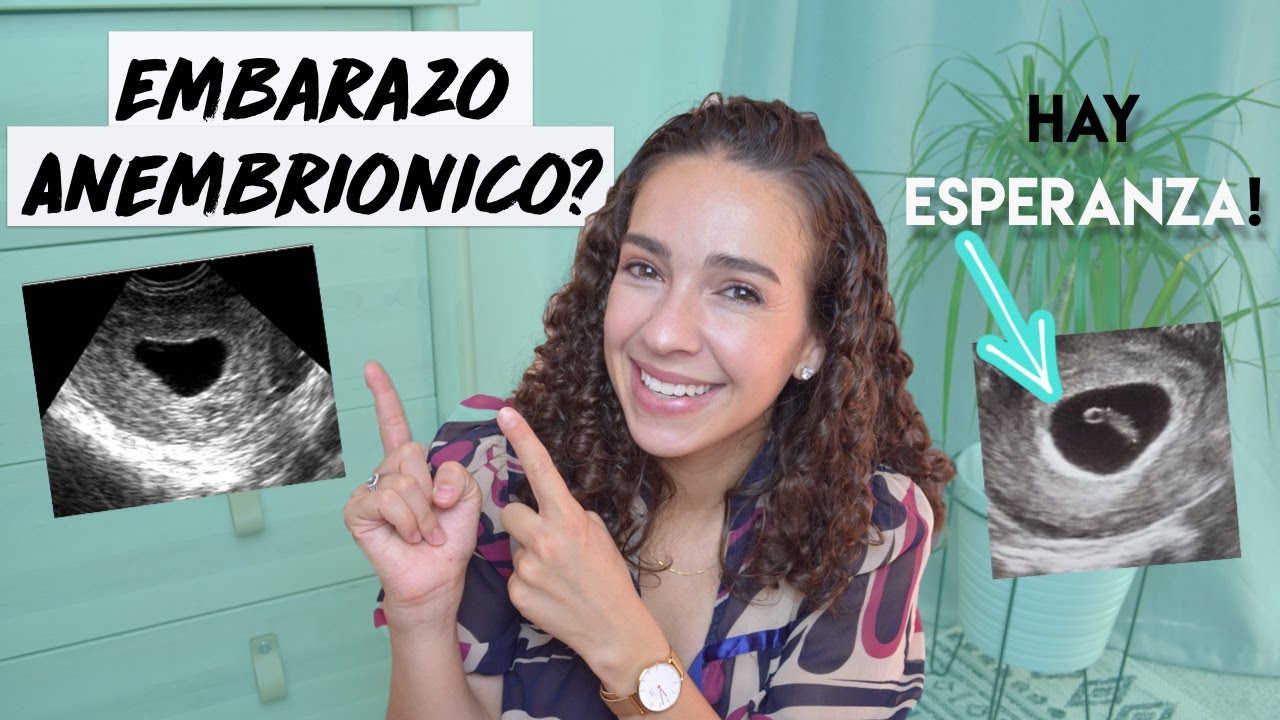 Cuanto tiempo tardé en embarazarme? | Embarazo Anembrionico