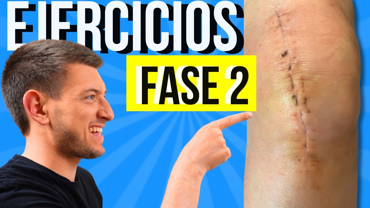 Ejercicios Para Prótesis de Rodilla o Reemplazo de Rodilla FASE 2 (Mes 2-3)