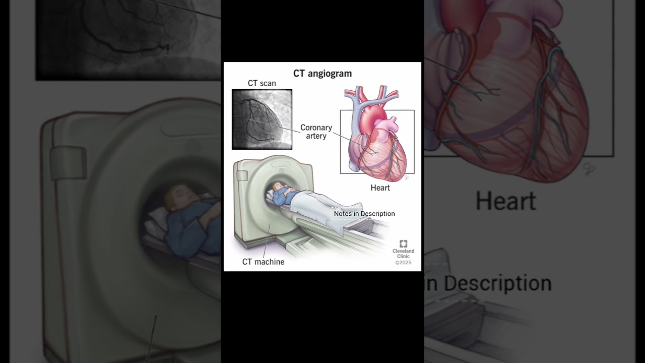What is CT angiogram 