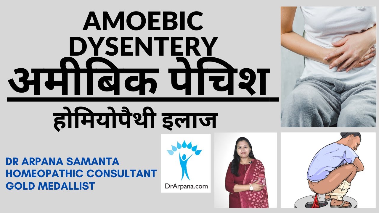 अमीबिक पेचिश पेट में दर्द, खूनी दस्त व होम्योपैथिक दवा | AMOEBIC DYSENTERY Homeopathic Treatment
