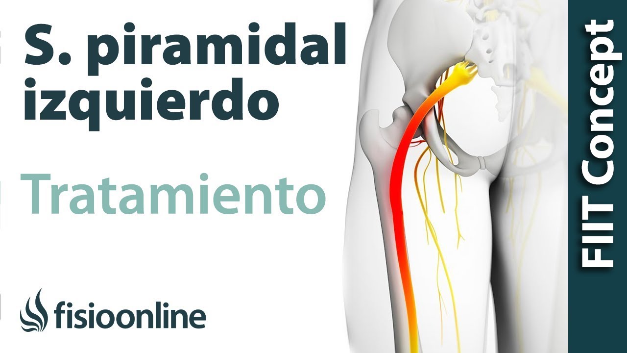 Tratamiento del s&iacute;ndrome piramidal izquierdo