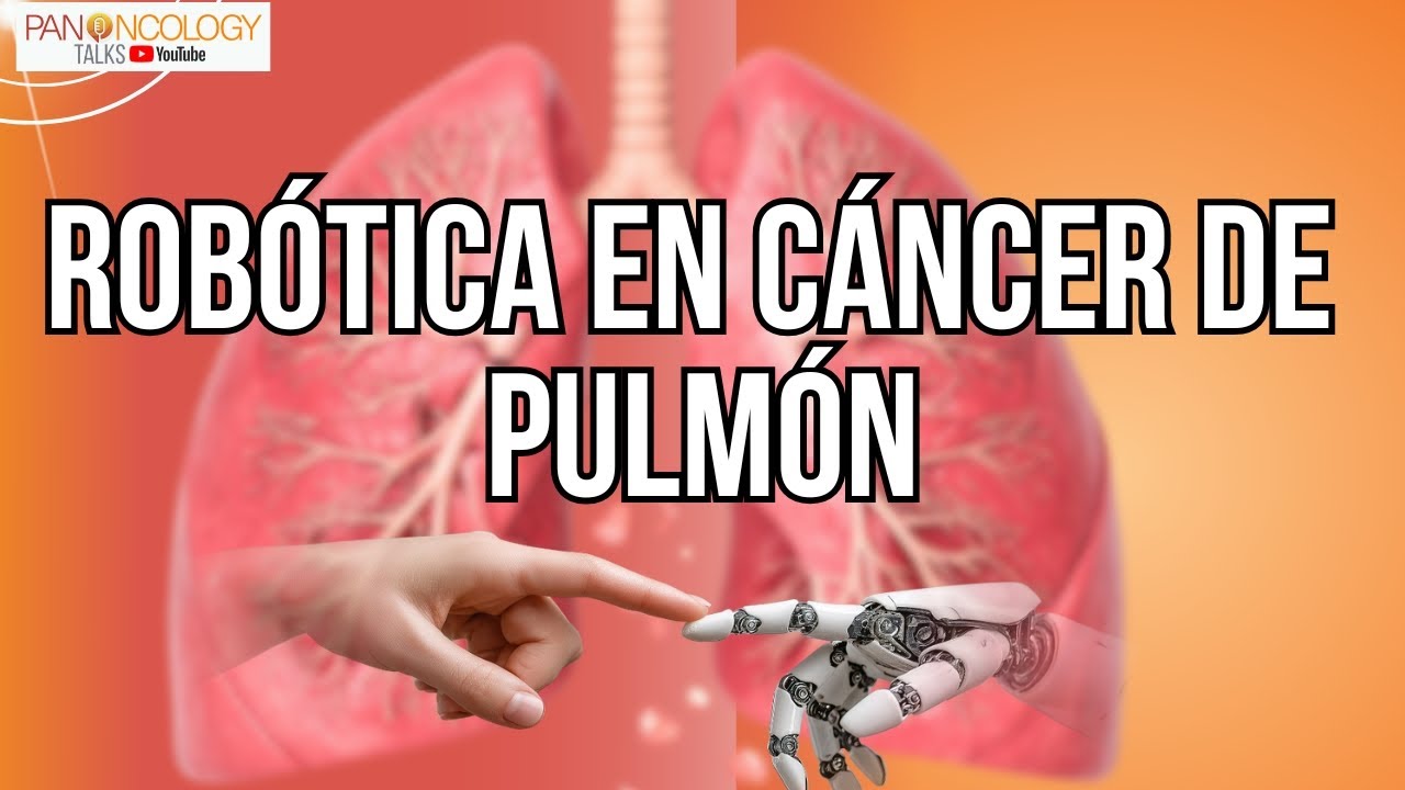 Robótica en Cáncer de Pulmón