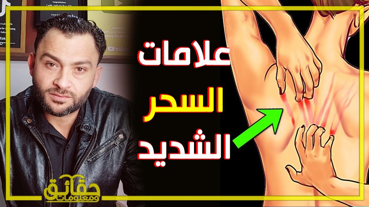 ماهي علامات السحر الشديد؟!