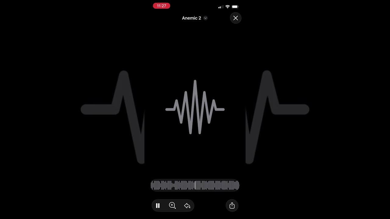 Anemic - sneak