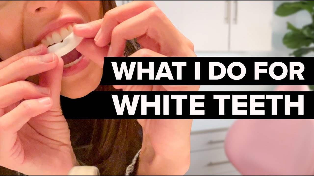 Teeth Whitening Routine As A Dental Hygienist
