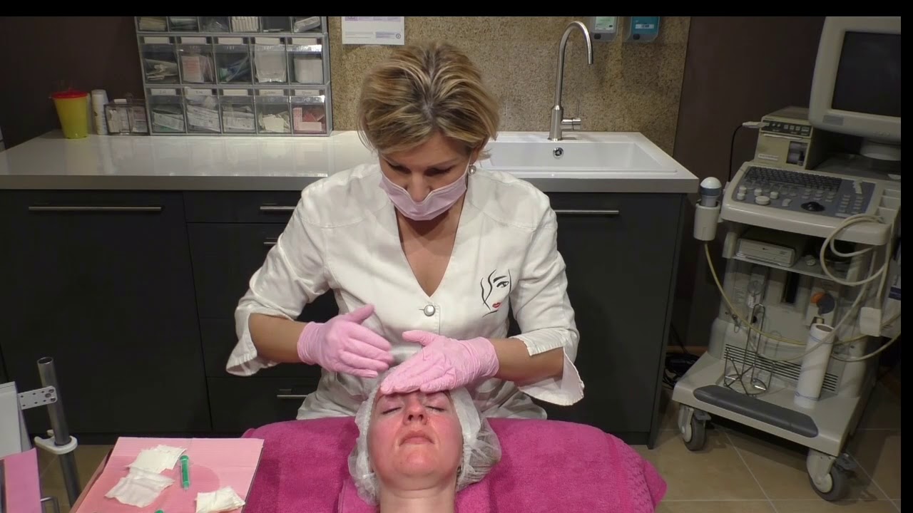 Micro Needling Schulungs-Video