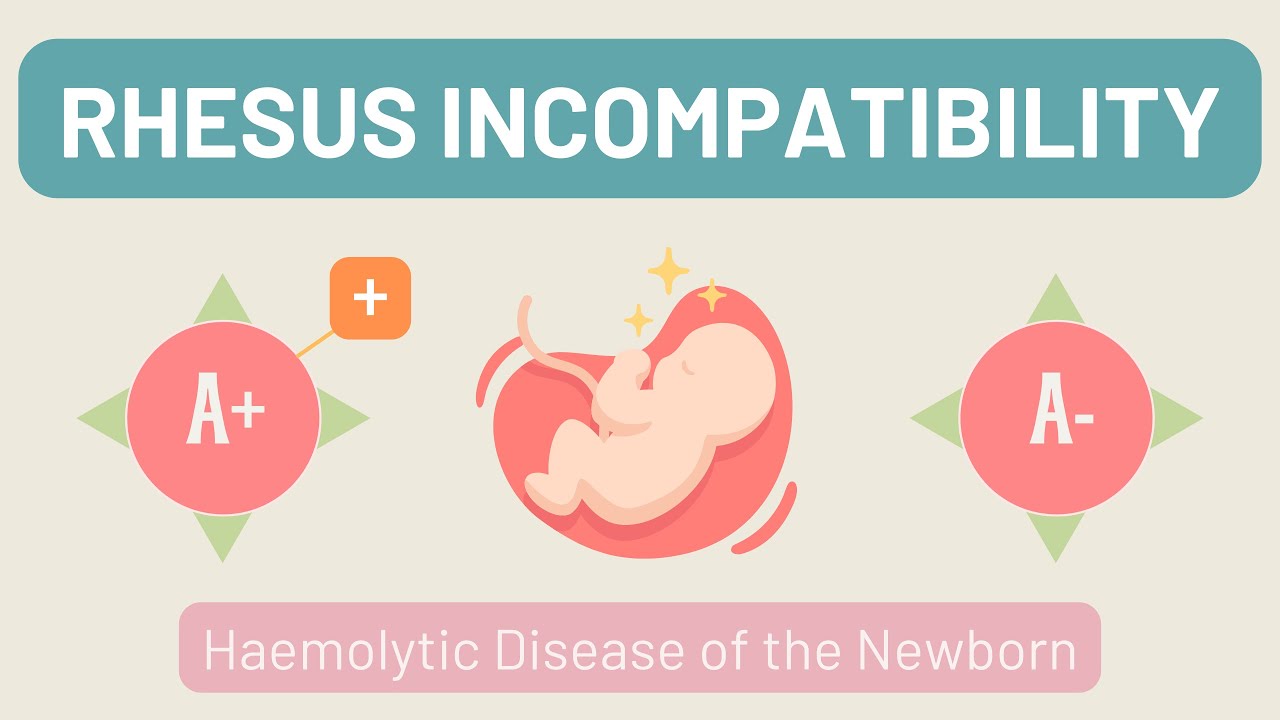 Rhesus Disease | Haemolytic Disease of the Newborn