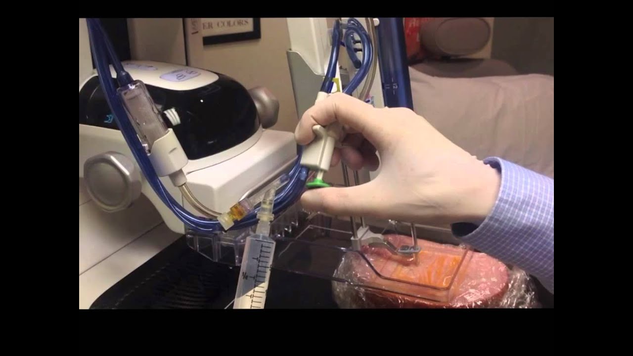 Tomo-guided breast biopsies