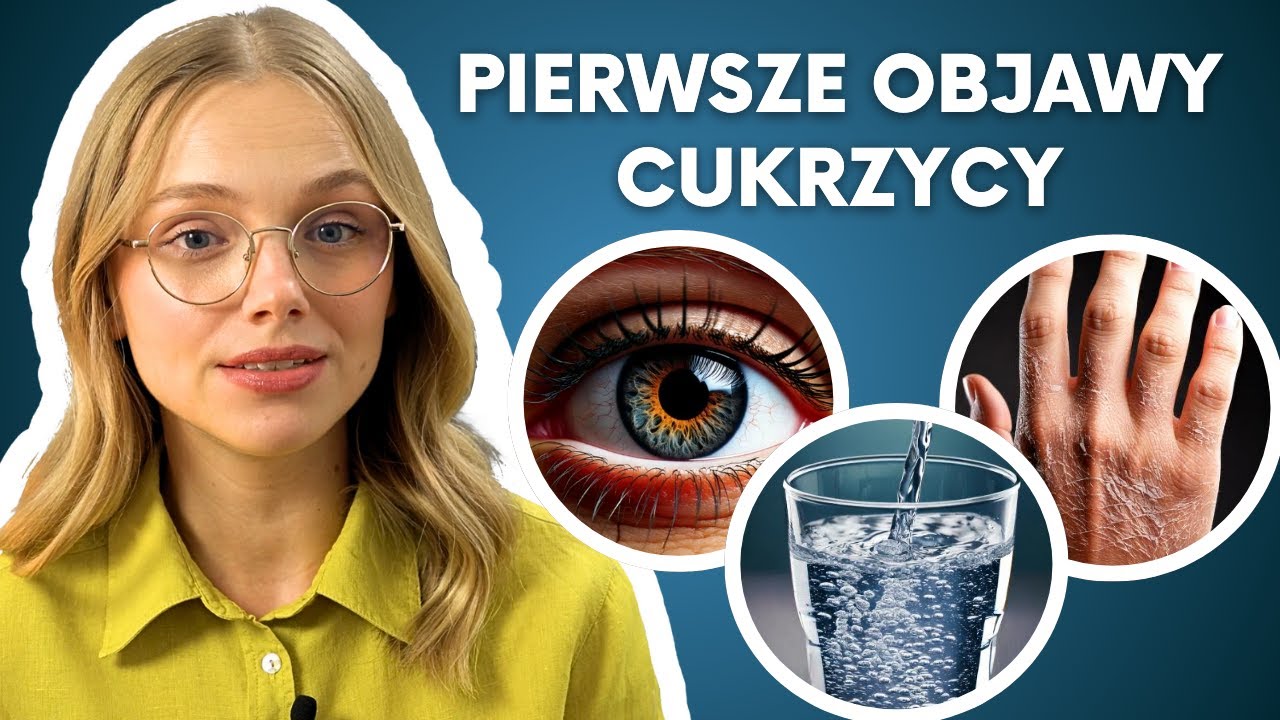 Co to jest cukrzyca typu 2? Pierwsze objawy cukrzycy typu 2. Jak rozpoznać wysoki poziom cukru?