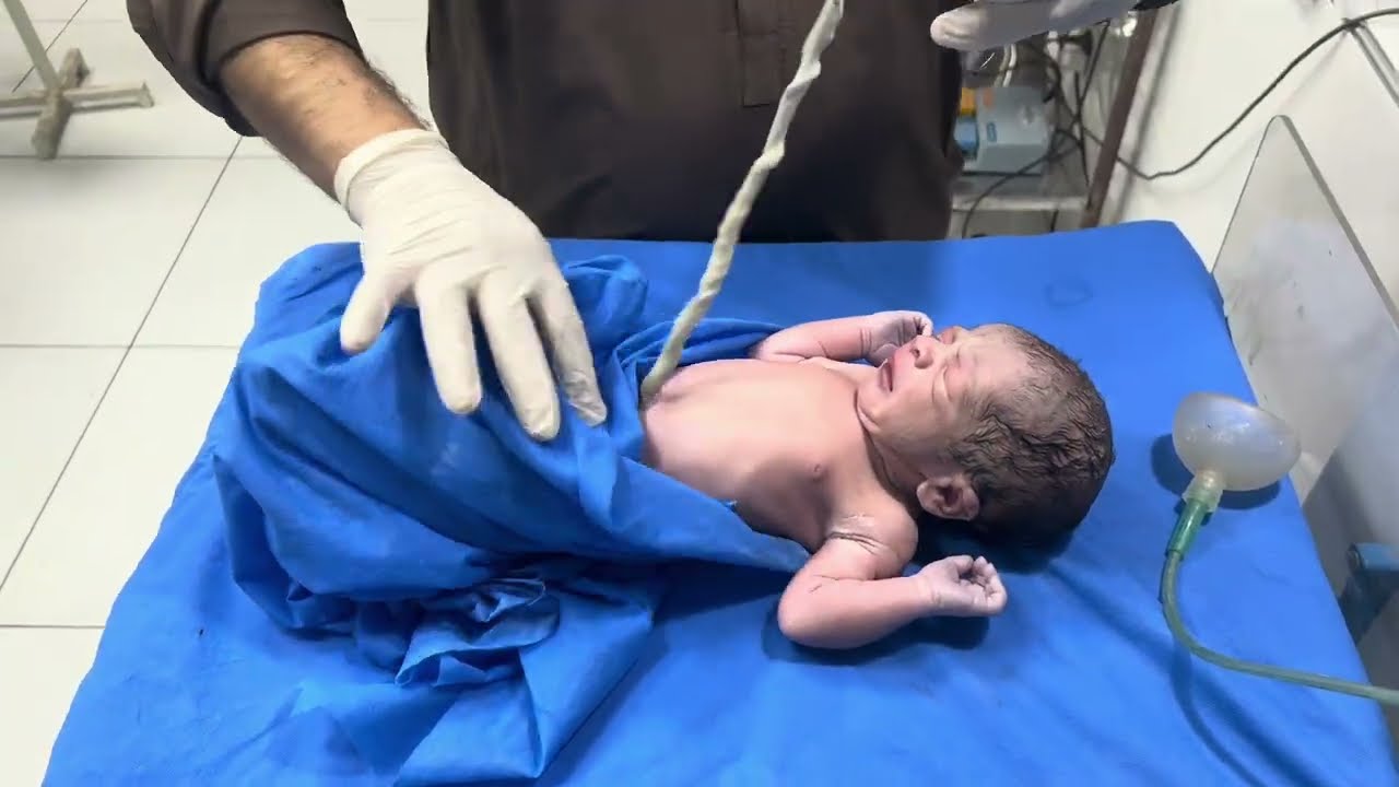 Newborn Baby IUGR – First Breath & First Cry After Emergency C-Section | Sumaira Kousar