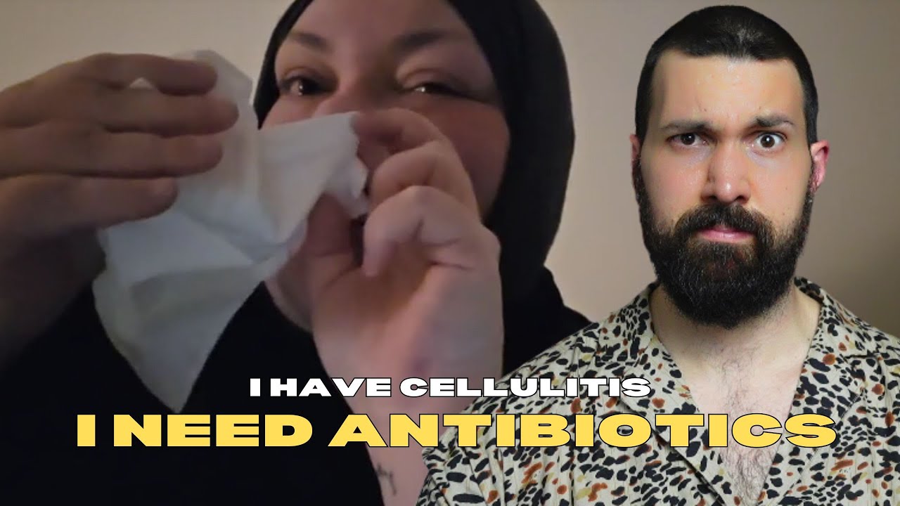 LIVE SNIPE The Day Of Cellulitis ft. Foodie Beauty