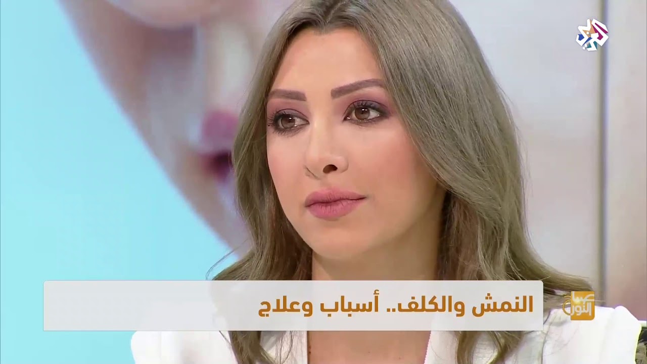 النمش والكلف .. أسباب وعلاج