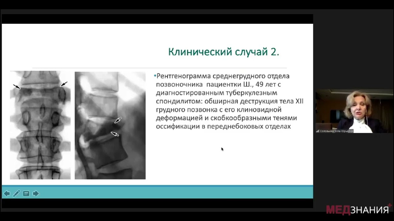 11  Лечение дорсопатий 27 10