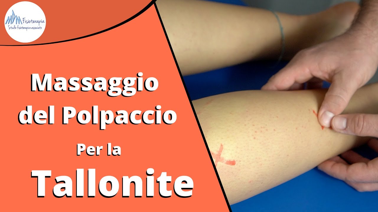 Massaggio del polpaccio per la tallonite: migliore tecnica per decontrarlo