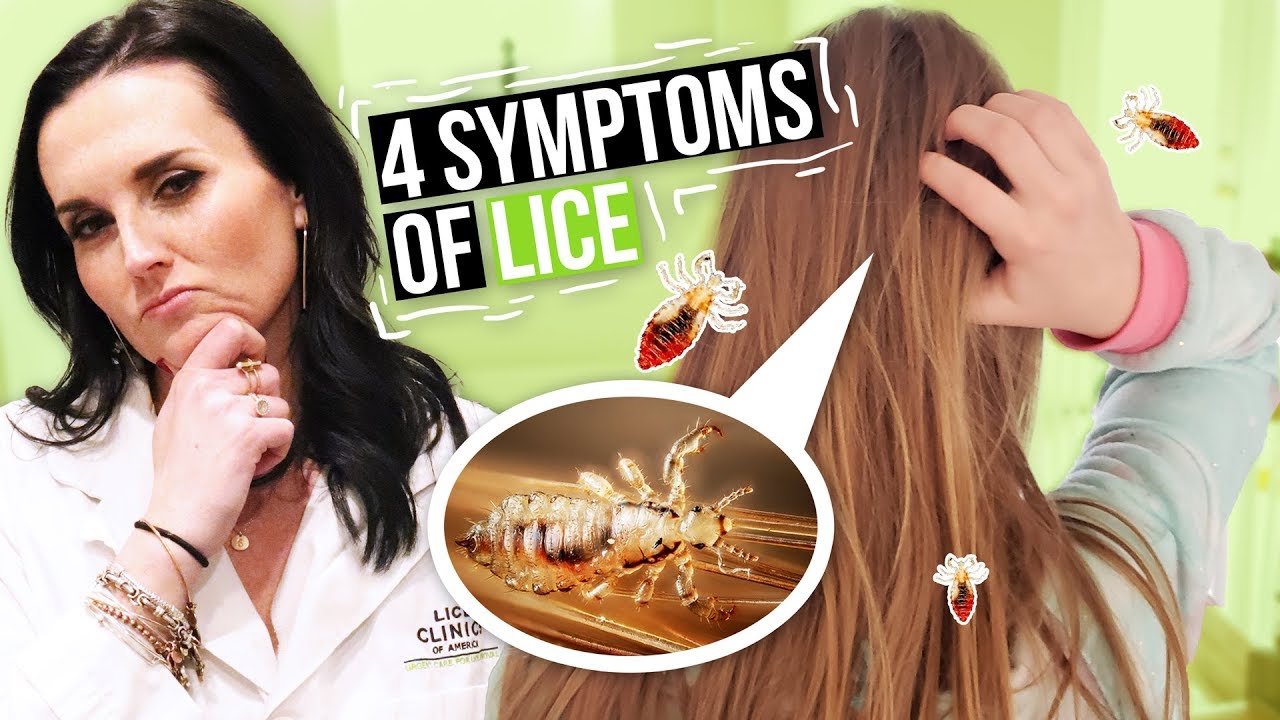 Head Lice Symptoms and Treatment - 4 Signs of Lice to Watch For