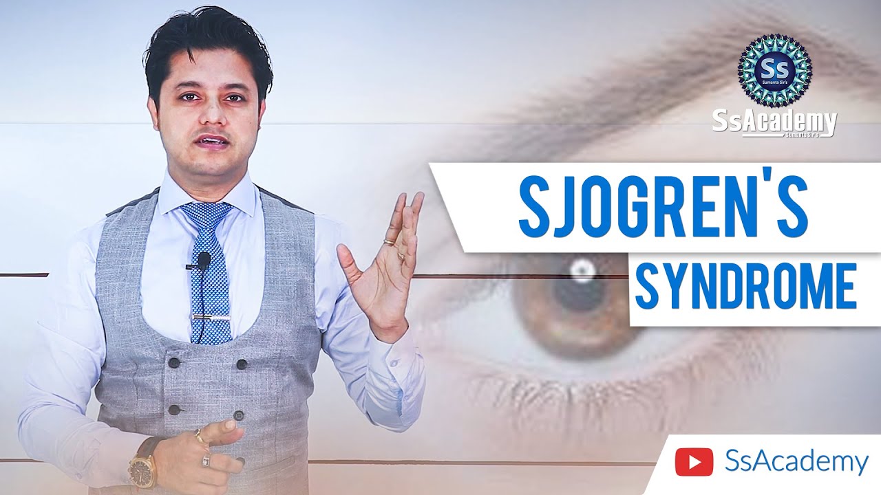 MRCP Part-1 | Sjogren's Syndrome
