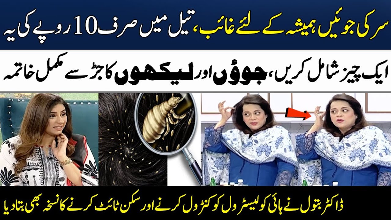 Sar Ki Juen Khatam Karne Ka Tarika (100%) | Head Lice Removal | Dr. Batool | Madeha Naqvi | SAMAA TV